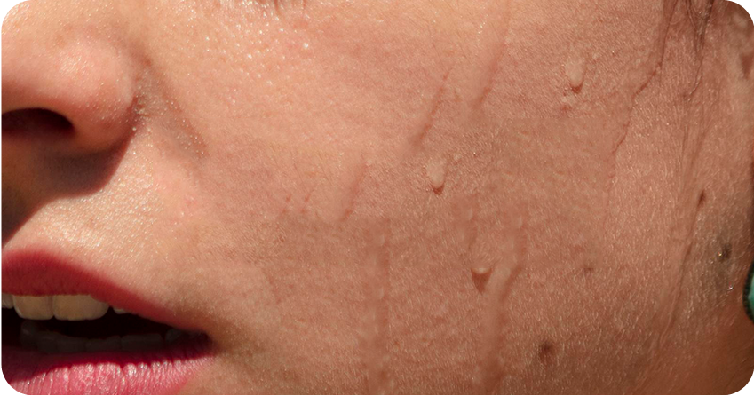 Why Do You Sweat After Applying Moisturizer? Explained!